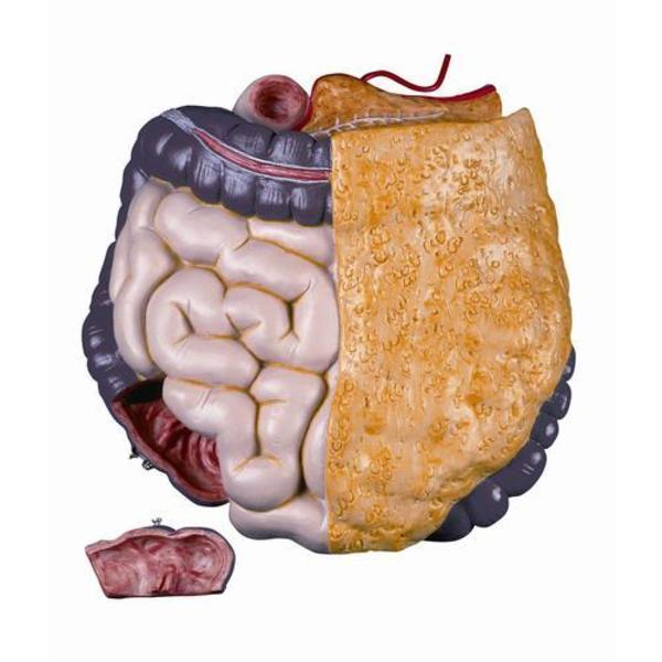 3B Scientific Torso: Whole intestine, 2-part 1020674